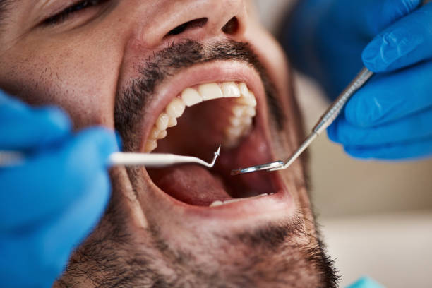 Best Emergency Tooth Extraction  in Manchester, IA